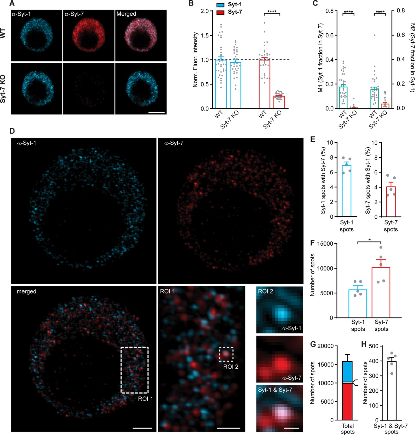 【楽天スーパーセール】 dense-core places Synaptotagmin-7 vesicles cell the at パーカッション・打楽器