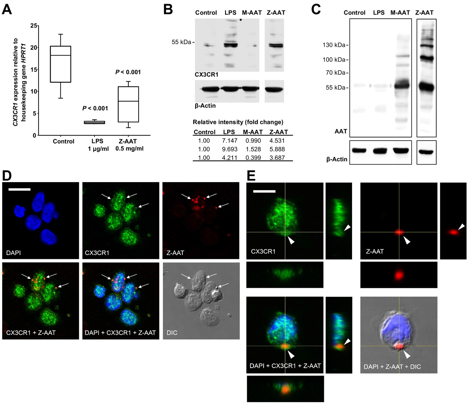 Figures in Polymerization of misfolded Z alpha-1 antitrypsin protein CX3CR1 expression in PBMCs | eLife