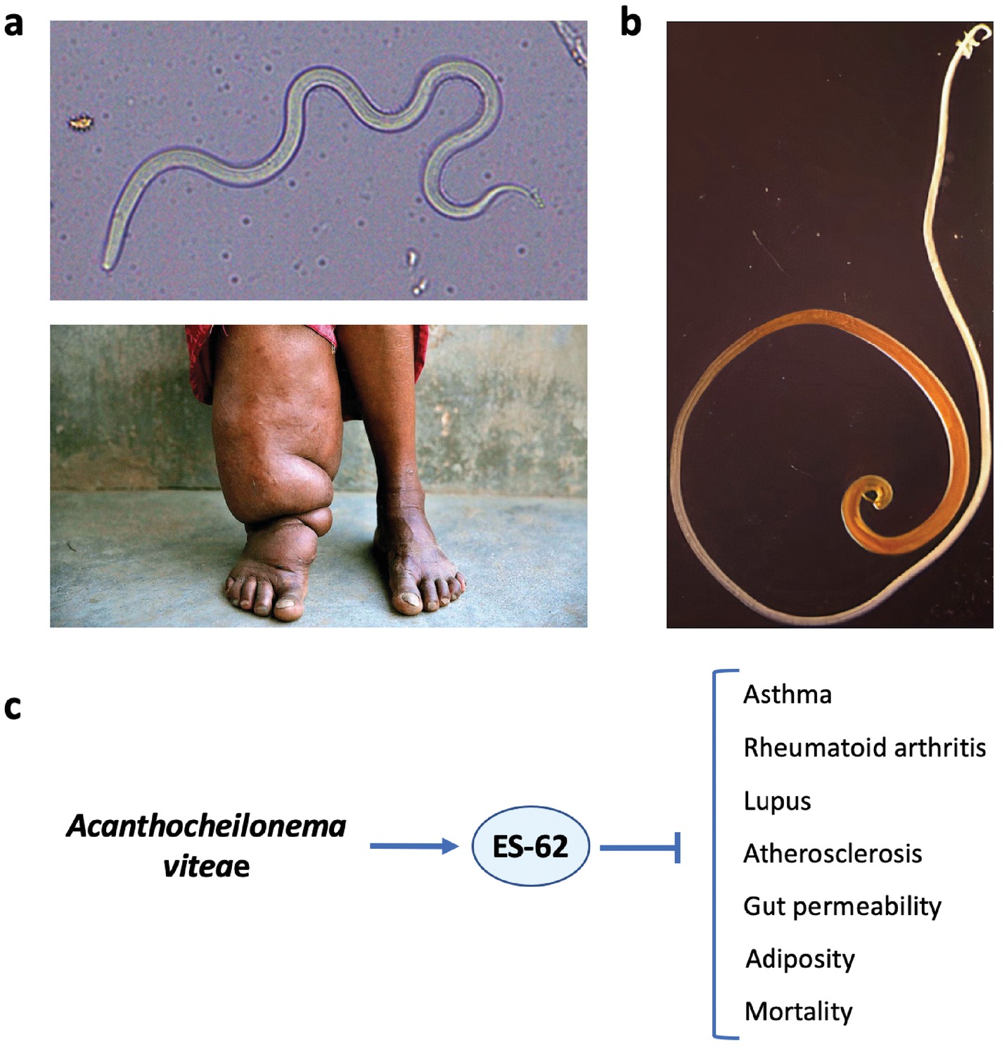 Helminth therapy for autoimmune disease. Helminth therapy autoimmune diseases