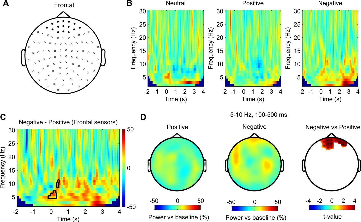 Increased Theta Alpha Synchrony In The Habenula Prefrontal Network With