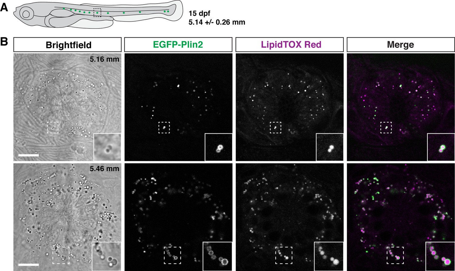 Imaging Cytoplasmic Lipid Droplets In Vivo With Fluorescent Perilipin 2 ...