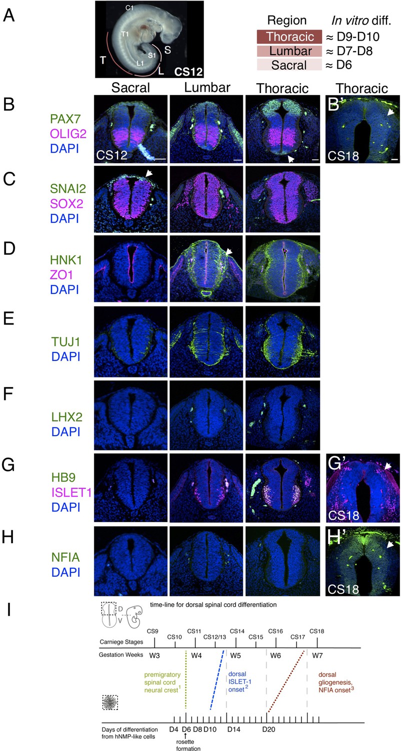 Human Spinal Cord In Vitro Differentiation Pace Is Initially Maintained