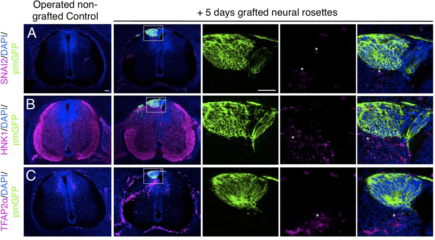 Human spinal cord in vitro differentiation pace is initially