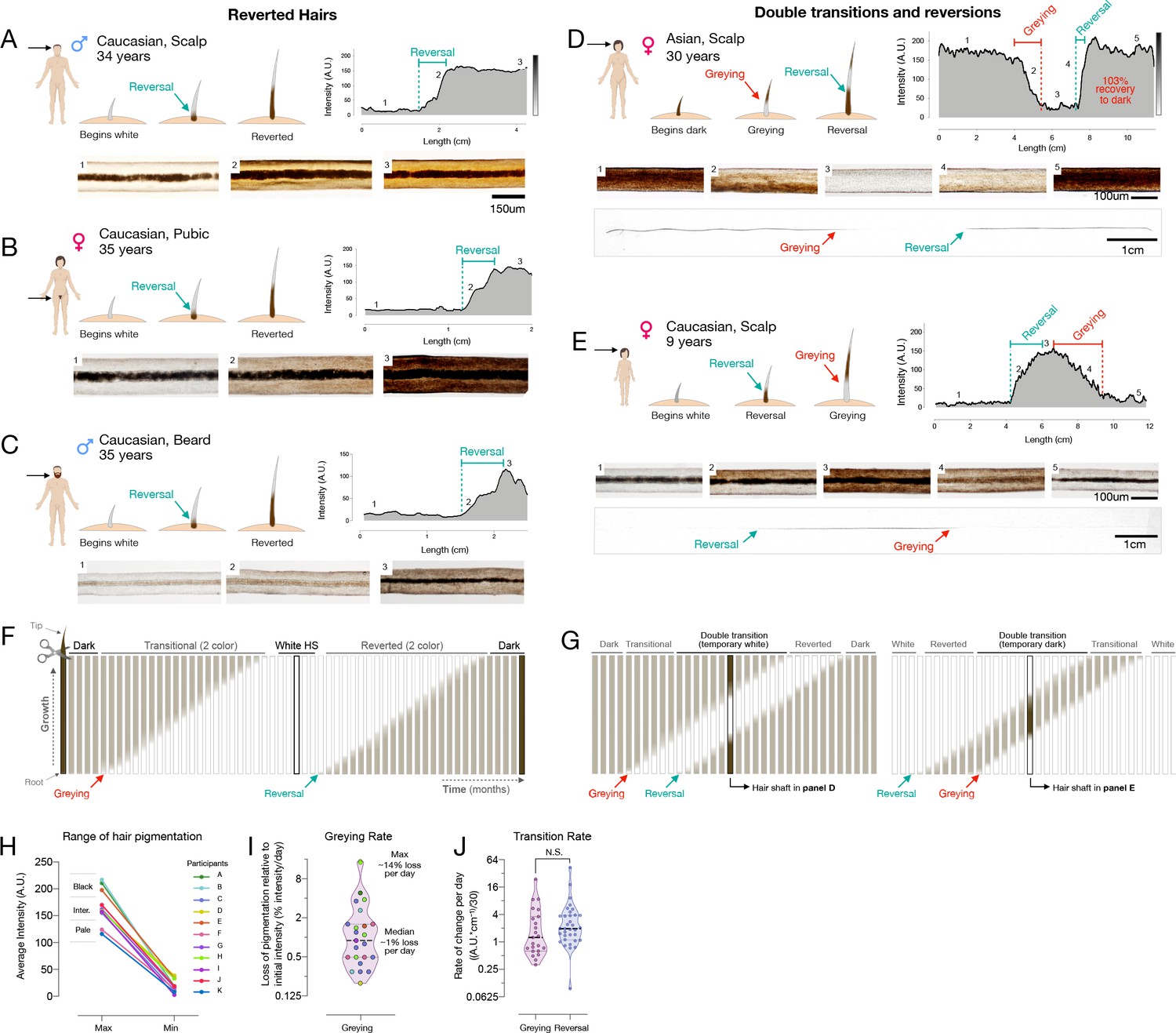 Quantitative mapping of human hair greying and reversal in relation to life  stress | eLife