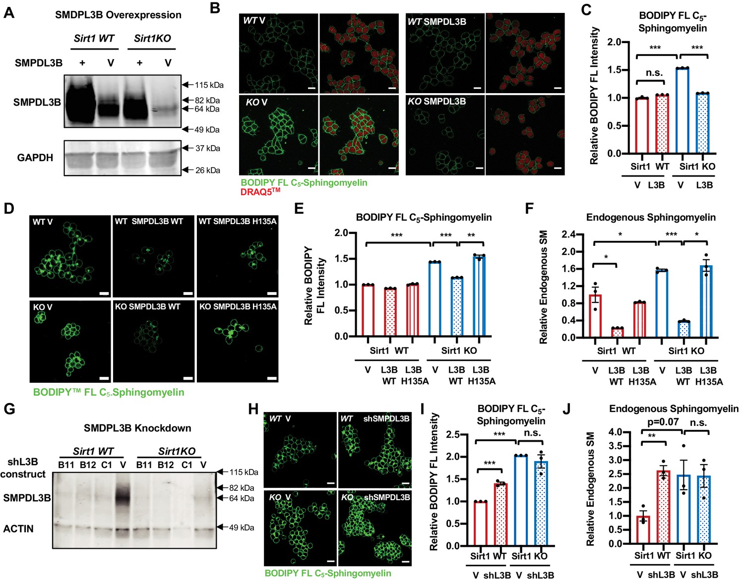 SIRT1 regulates sphingolipid metabolism and neural differentiation 