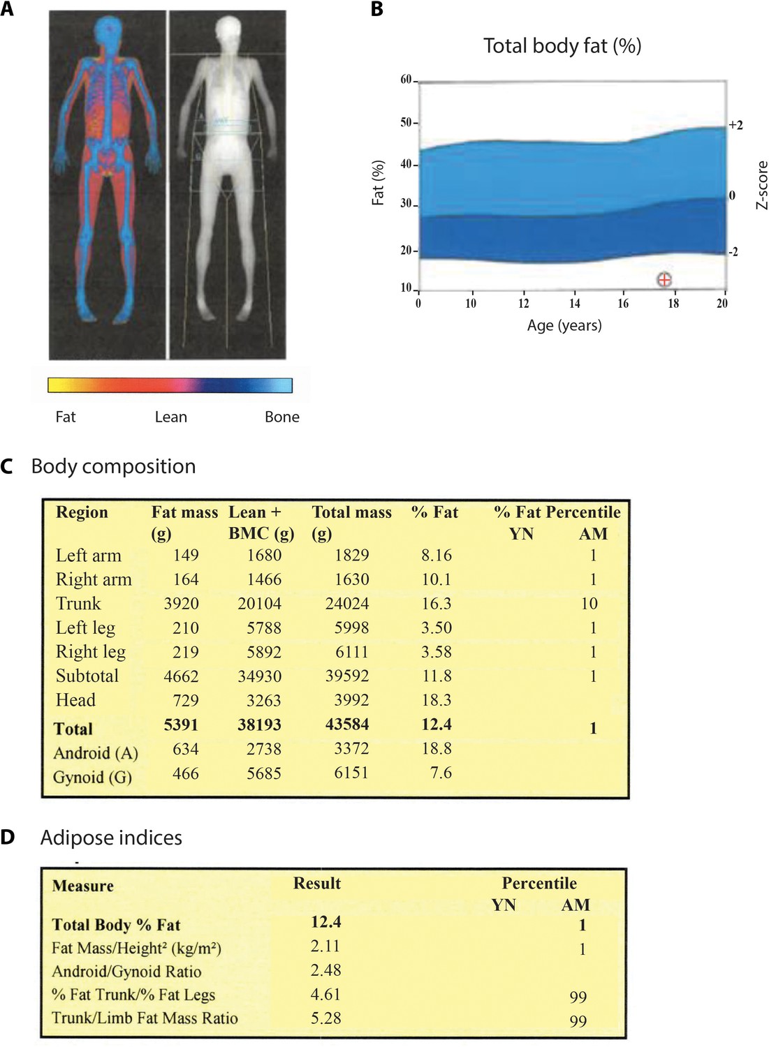 GE Healthcare body composition report sample