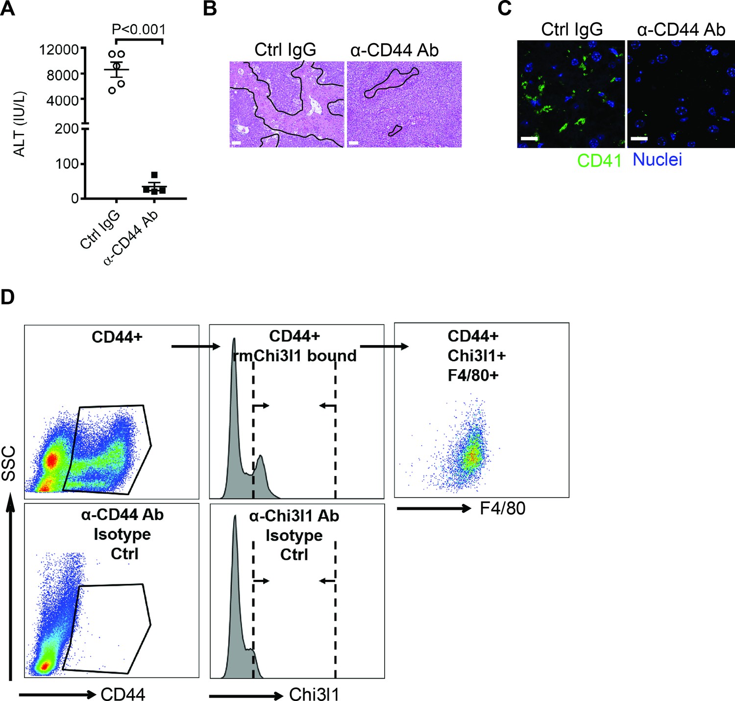 Chitinase 3-like-1 contributes to acetaminophen-induced