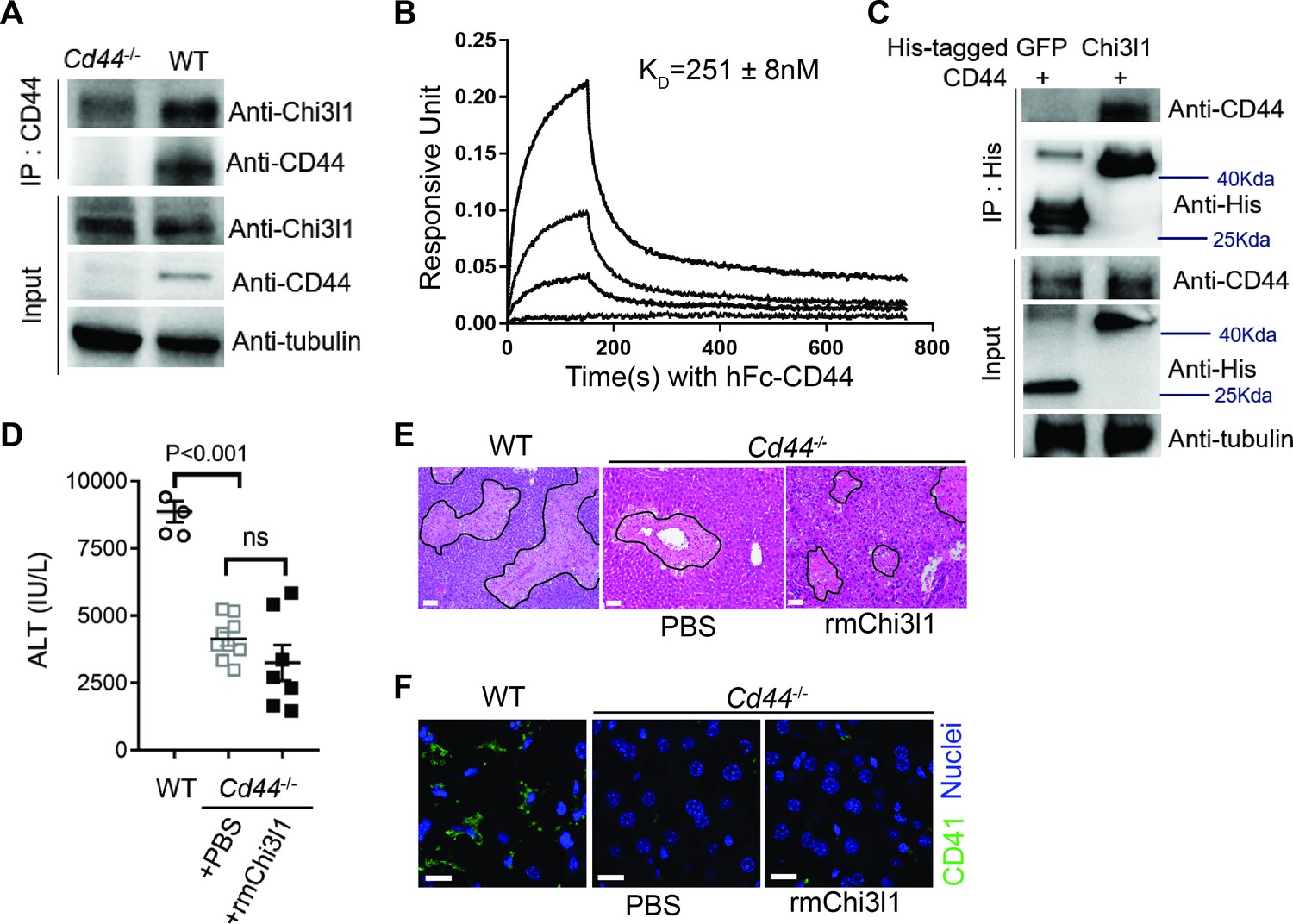 Figures And Data In Chitinase Like Contributes To Acetaminophen