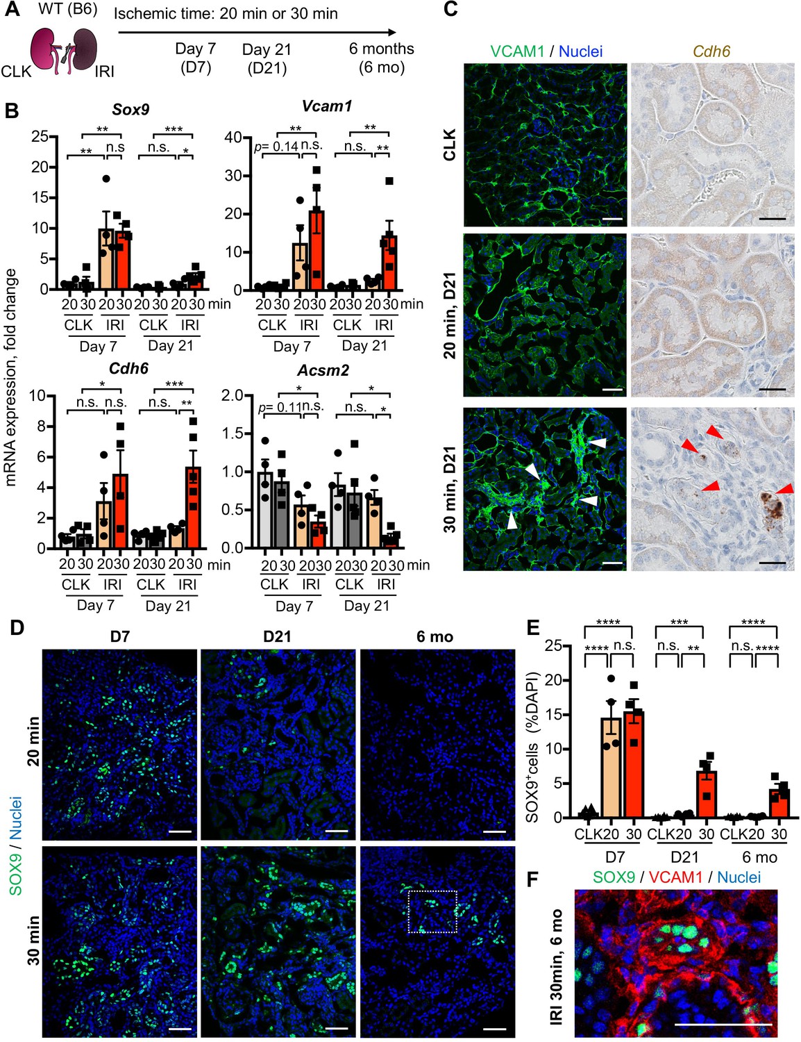 Ferroptotic stress promotes the accumulation of pro-inflammatory ...