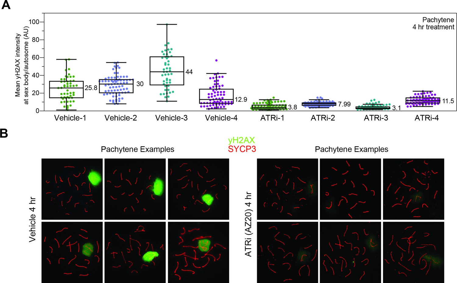 Figures And Data In Phosphoproteomics Of Atr Signaling In Mouse Testes Elife