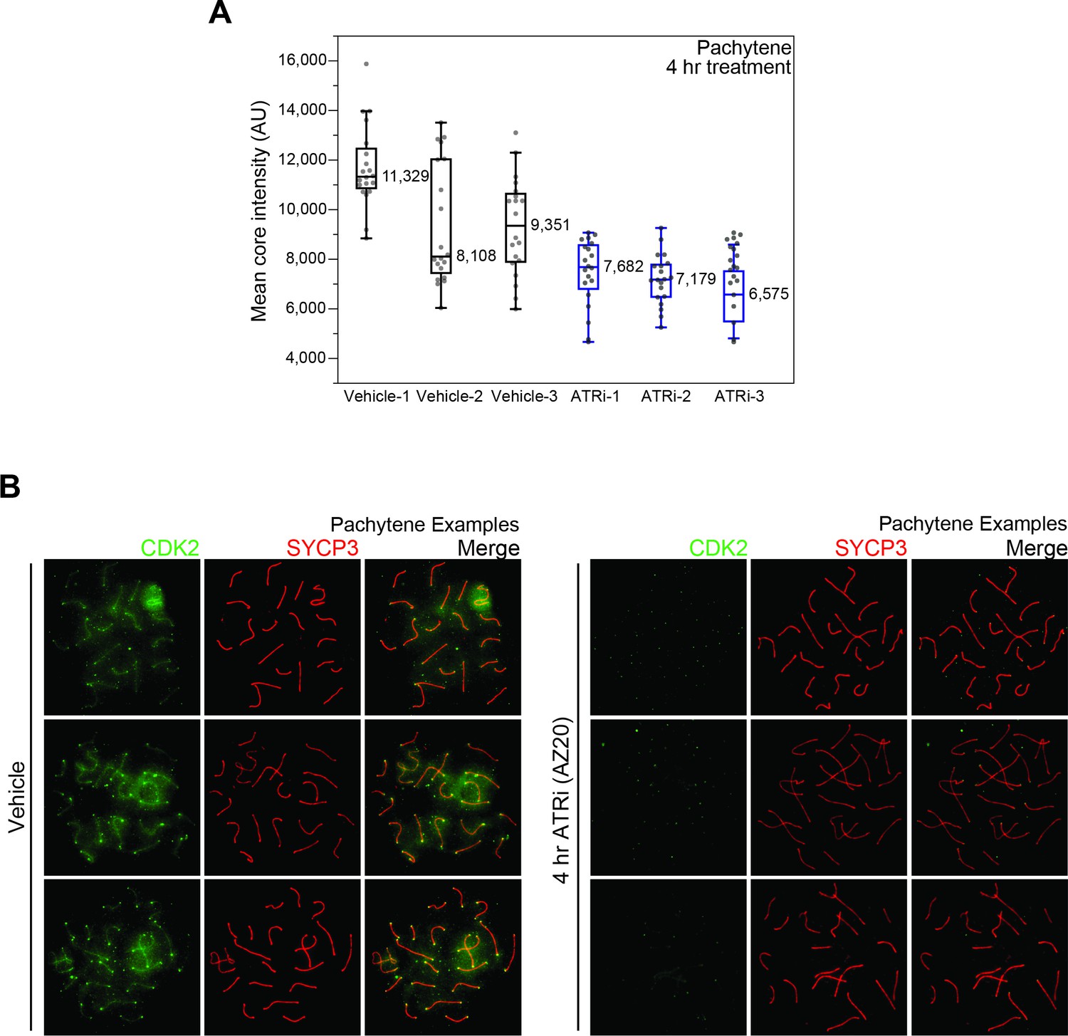 Figures And Data In Phosphoproteomics Of Atr Signaling In Mouse Testes Elife