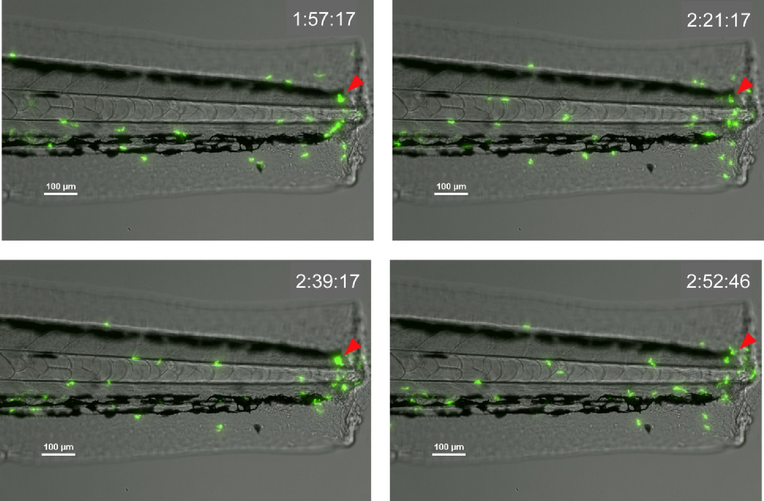 Figures And Data In Pioneer Neutrophils Release Chromatin Within In ...