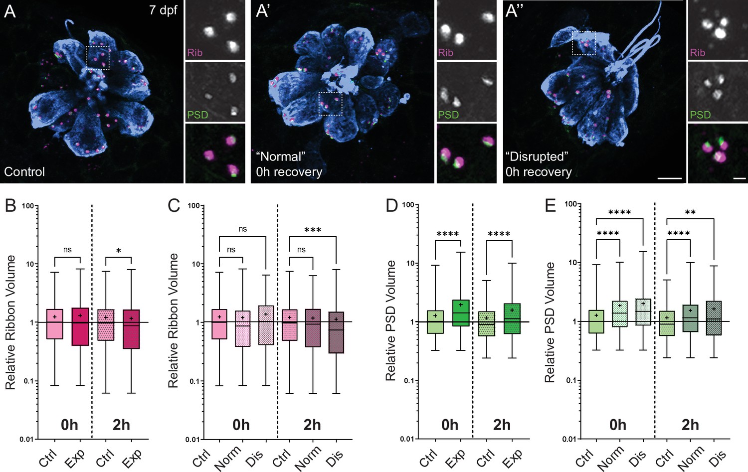 Mechanical overstimulation causes acute injury and synapse