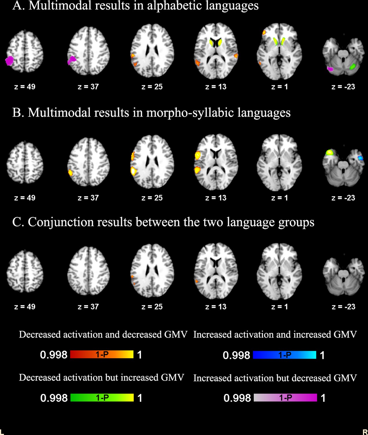 Convergent and divergent brain structural and functional