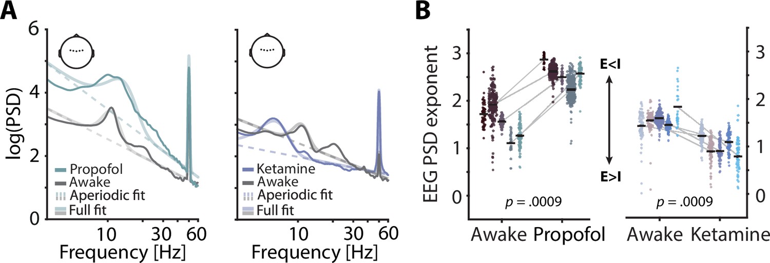 eeg 2012年 Frontiers | E2SGAN: EEG-to-SEEG translation with generative
