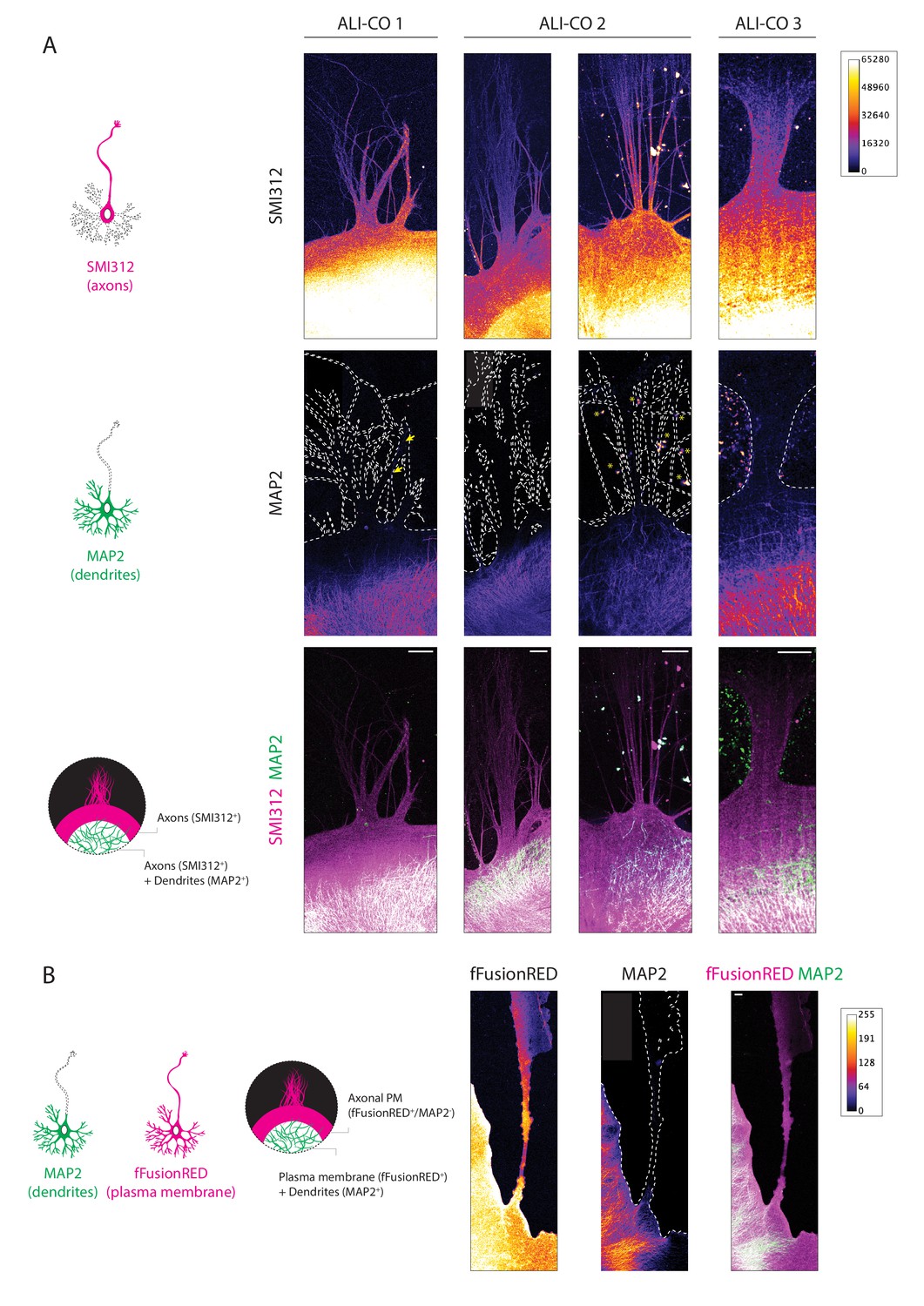 Figures And Data In Electron Cryo-tomography Reveals The Subcellular ...