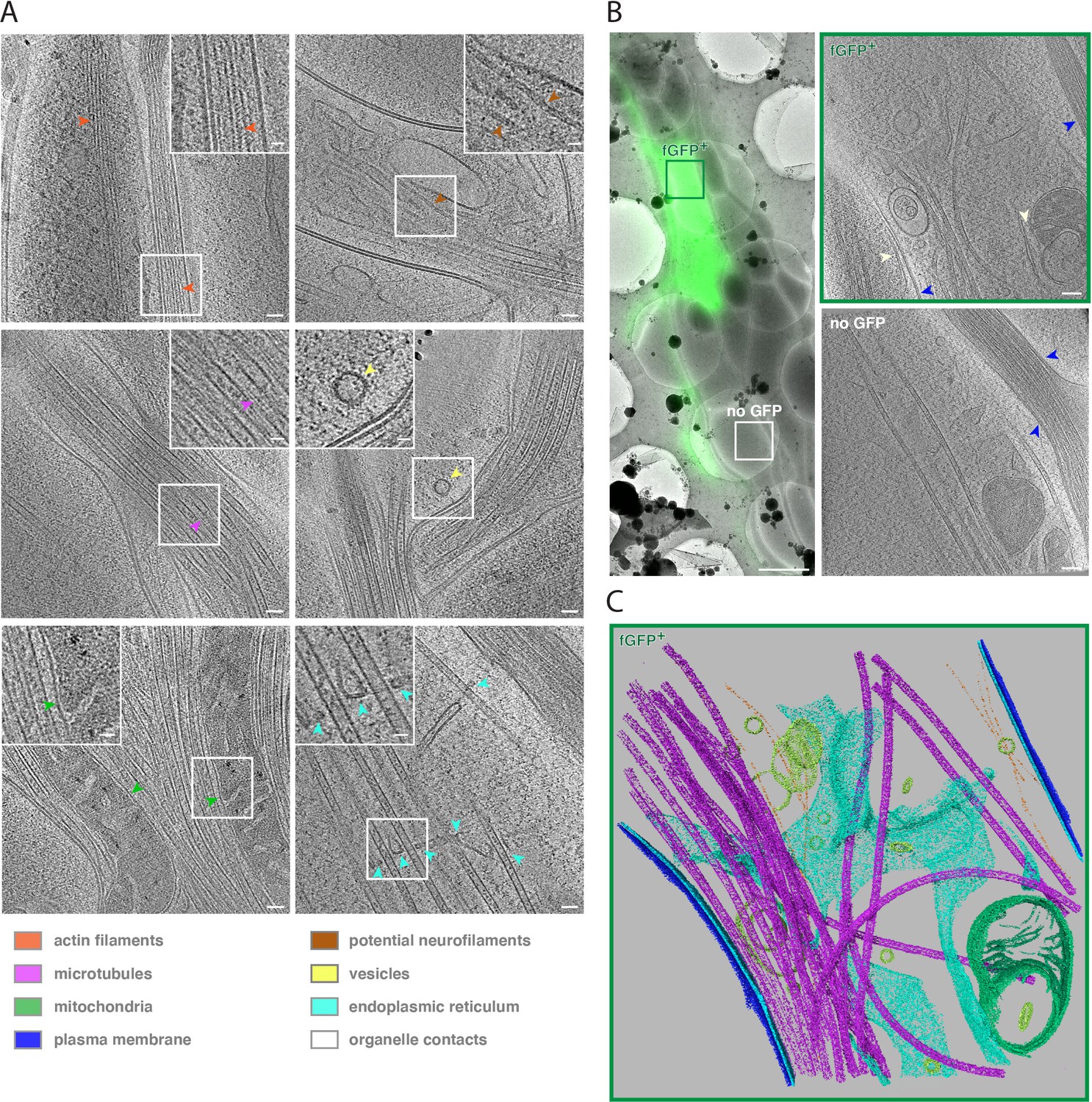 Electron Cryo-tomography Reveals The Subcellular Architecture Of ...