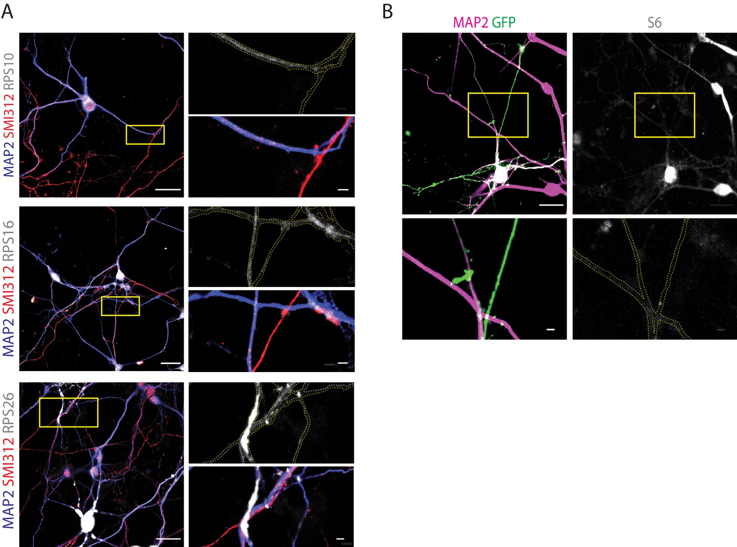 Figures And Data In Electron Cryo-tomography Reveals The Subcellular ...