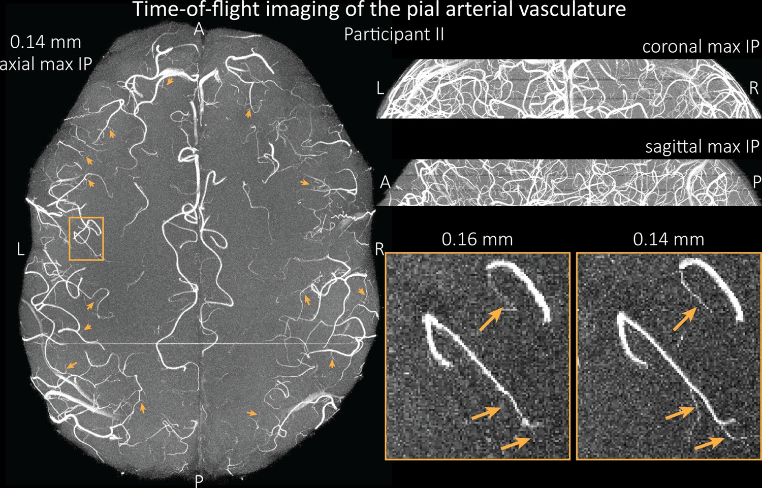 Figures and data in Imaging of the pial arterial vasculature of the ...