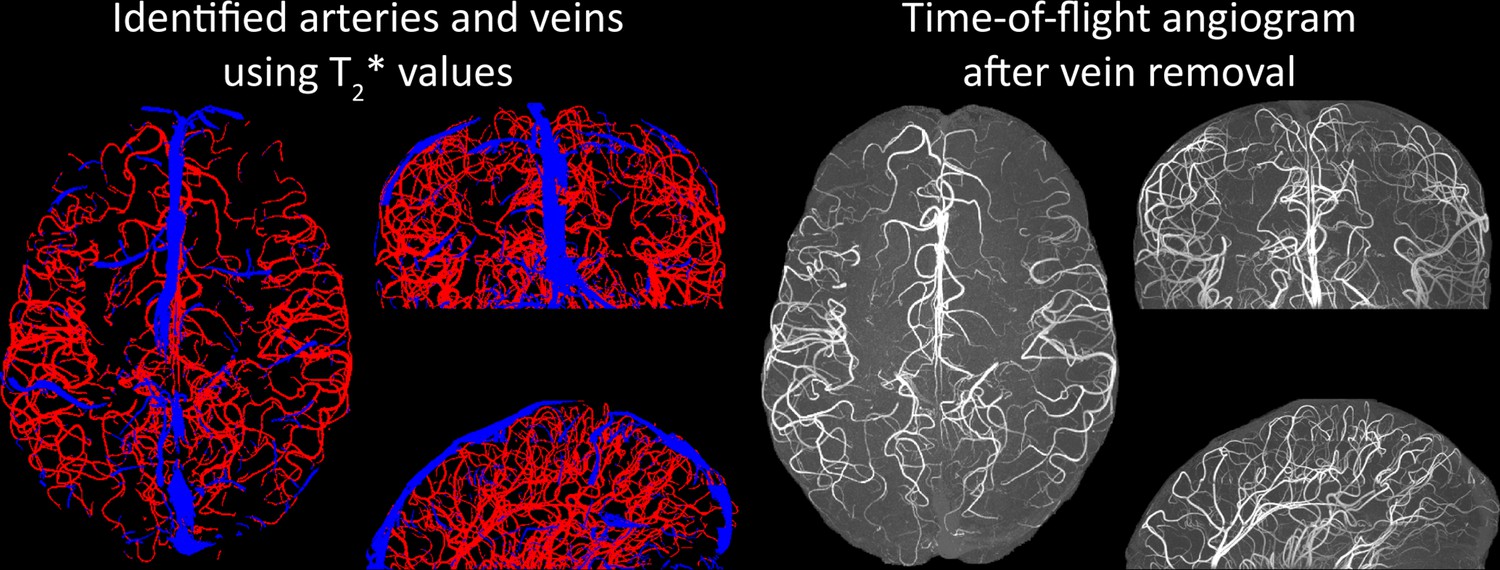 Imaging of the pial arterial vasculature of the human brain in vivo ...