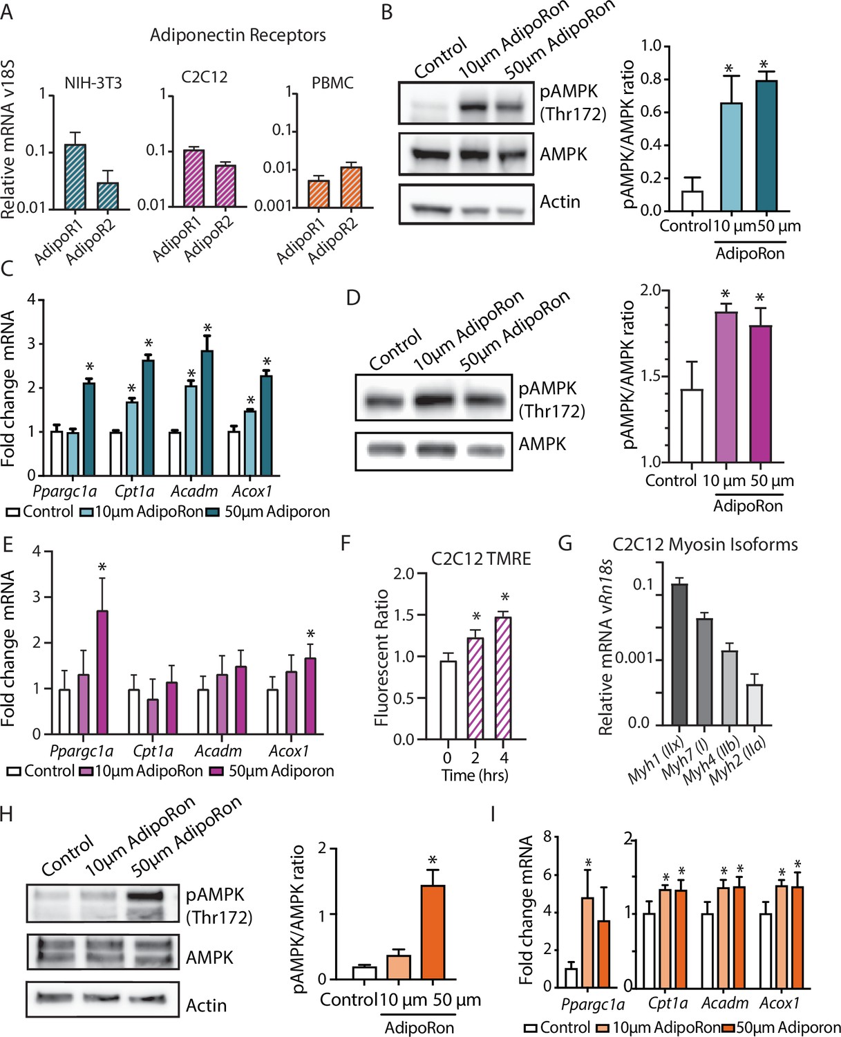 Epigenetic modifications in muscle regeneration and