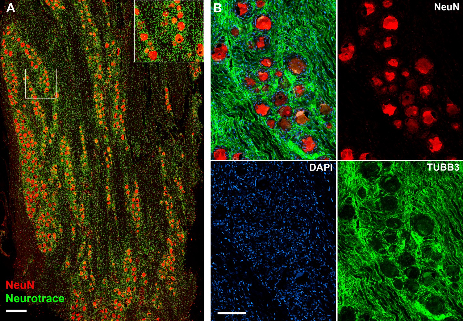 Figures And Data In Single Nucleus Transcriptomic Analysis Of Human