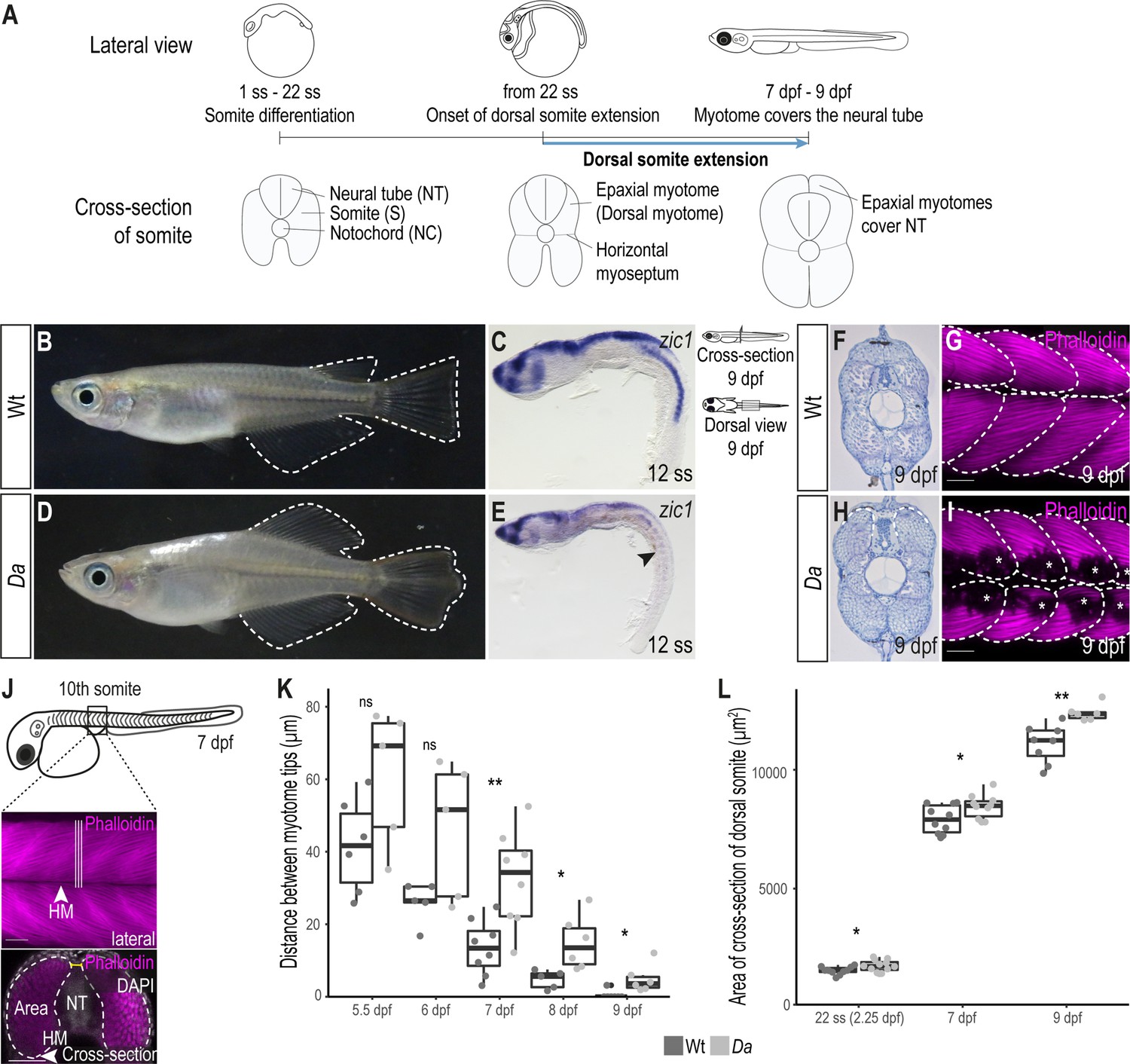 Wnt11 acts on dermomyotome cells to guide epaxial myotome Wnt11 acts on dermomyotome cells to guide epaxial myotome