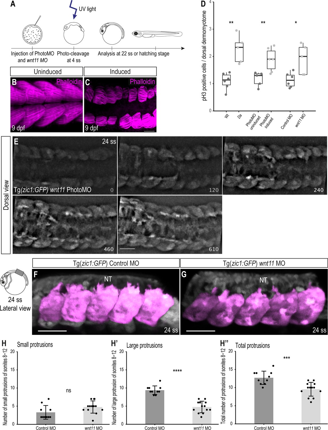 Wnt11 acts on dermomyotome cells to guide epaxial myotome Wnt11 acts on dermomyotome cells to guide epaxial myotome