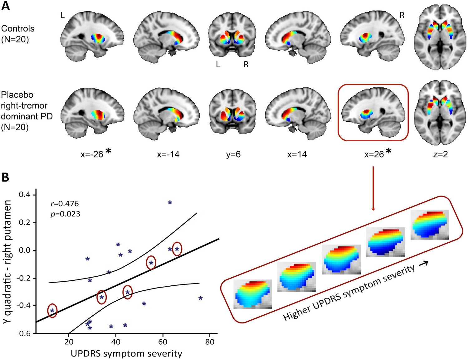 Mapping Dopaminergic Projections In The Human Brain With Resting-state ...