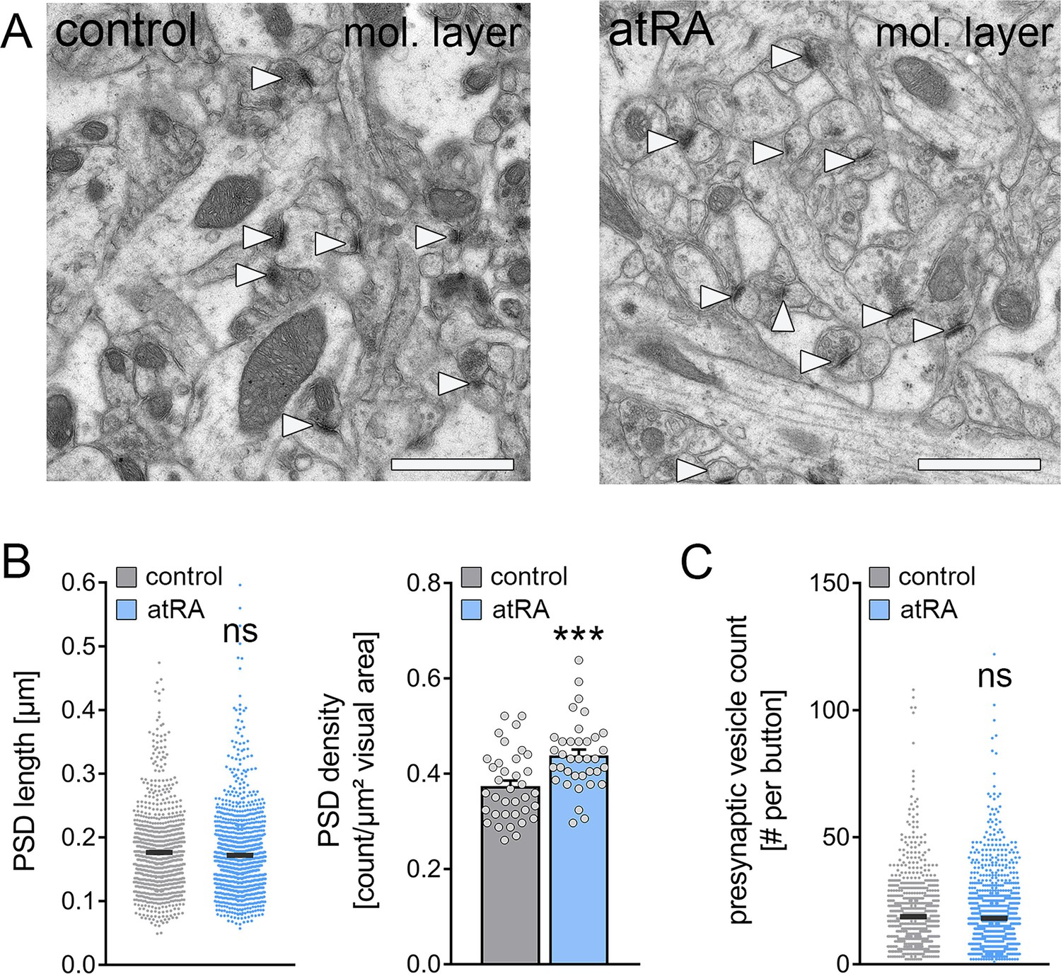 Figures And Data In All Trans Retinoic Acid Induces Synaptopodin