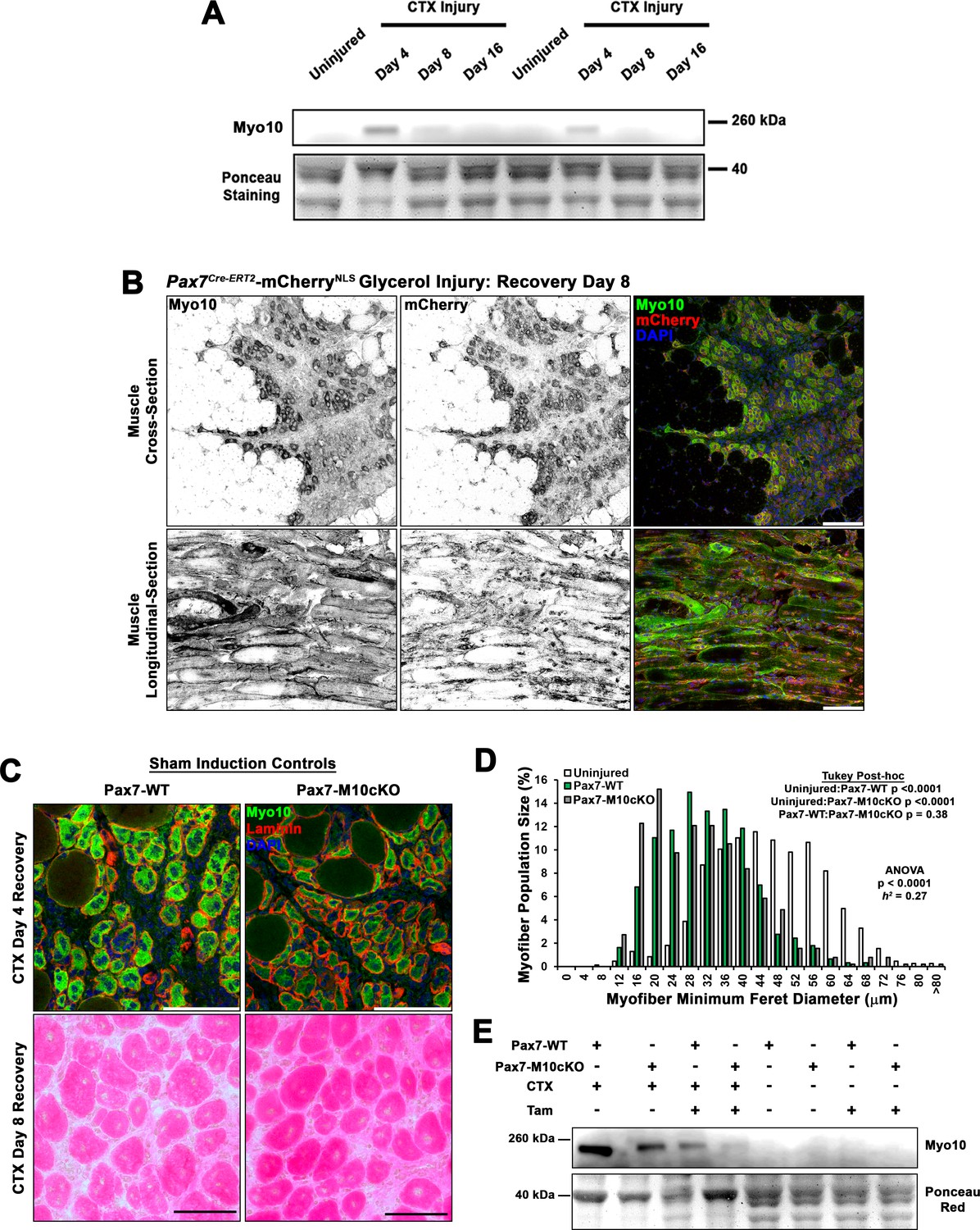 Figures and data in Filopodia powered by class x myosin promote fusion ...