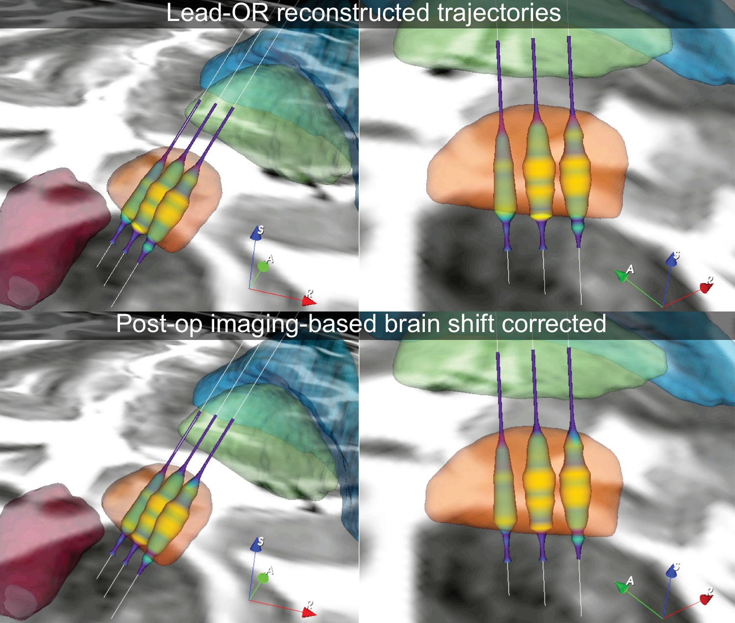 Figures And Data In Lead-OR: A Multimodal Platform For Deep Brain ...