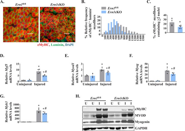 The IRE1/XBP1 Signaling Axis Promotes Skeletal Muscle Regeneration ...