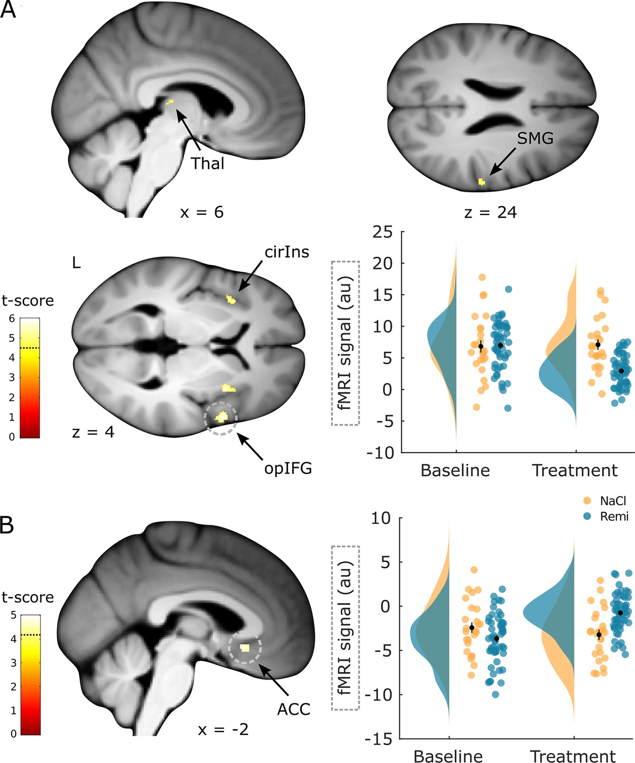 Figures And Data In Opioid Analgesia Alters Corticospinal Coupling ...