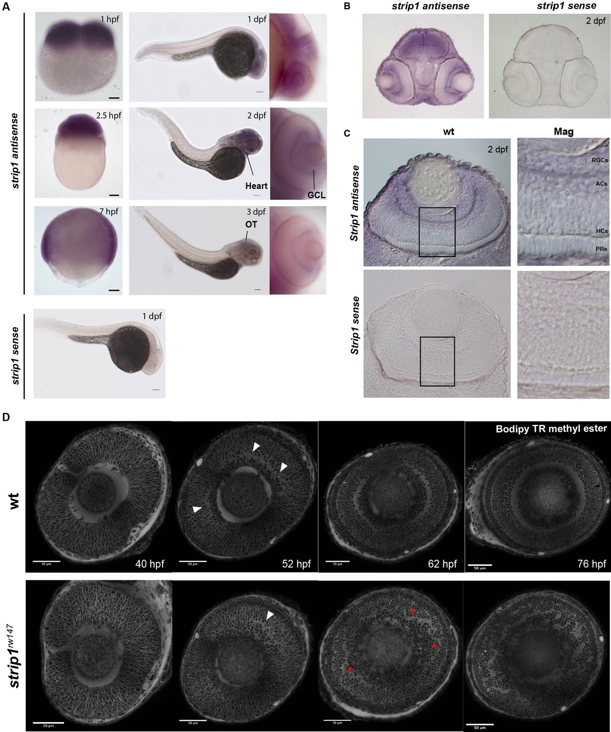 Figures And Data In Strip1 Regulates Retinal Ganglion Cell Survival By ...