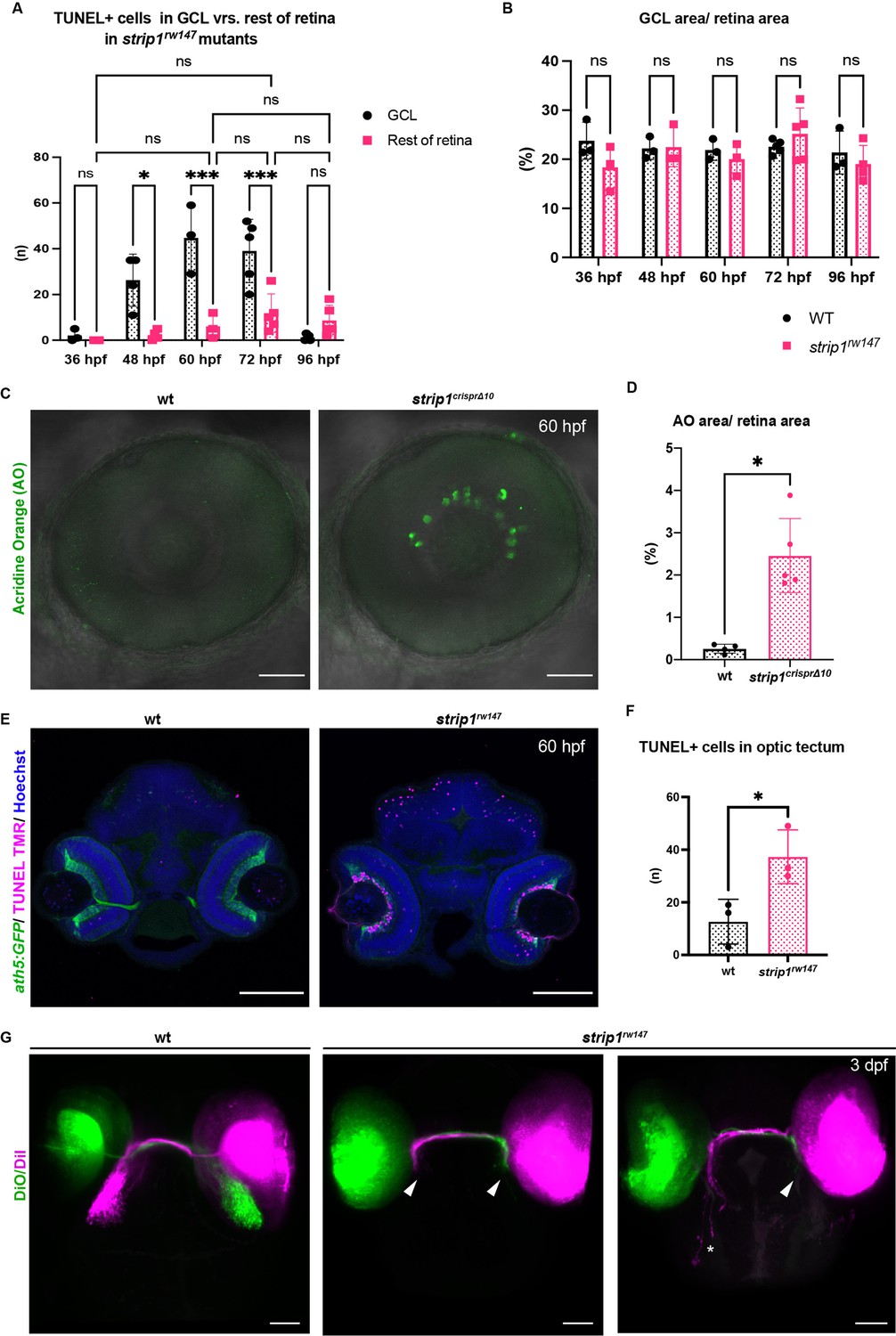 Figures And Data In Strip1 Regulates Retinal Ganglion Cell Survival By ...