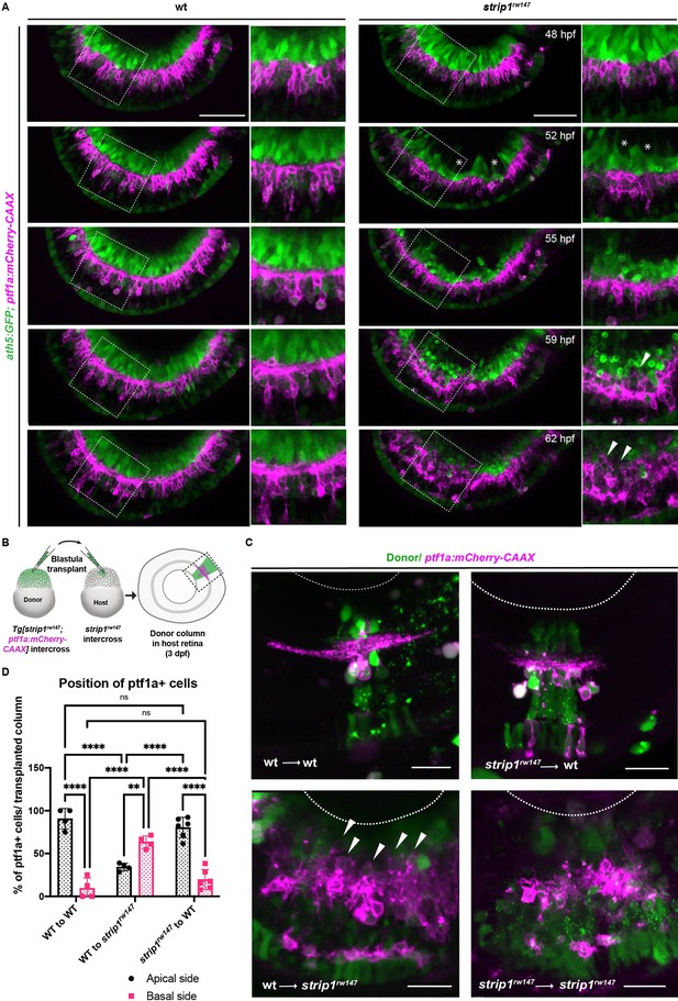 Strip1 Regulates Retinal Ganglion Cell Survival By Suppressing Jun ...