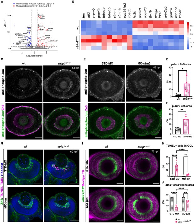 Strip1 Regulates Retinal Ganglion Cell Survival By Suppressing Jun ...