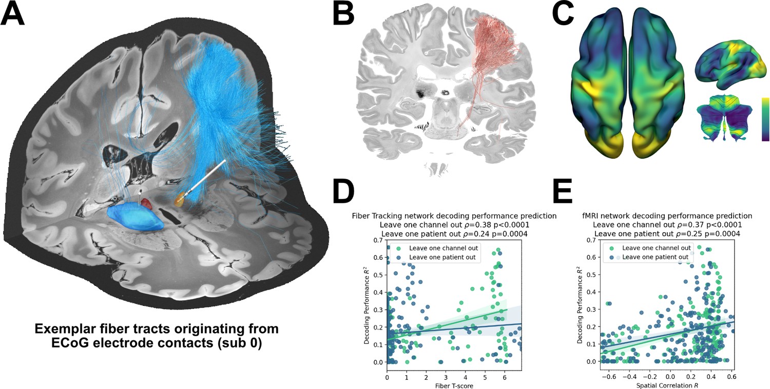 Electrocorticography is superior to subthalamic local field Electrocorticography is superior to subthalamic local field