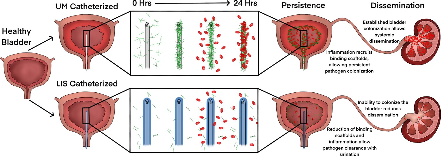 Inhibiting hostprotein deposition on urinary catheters reduces