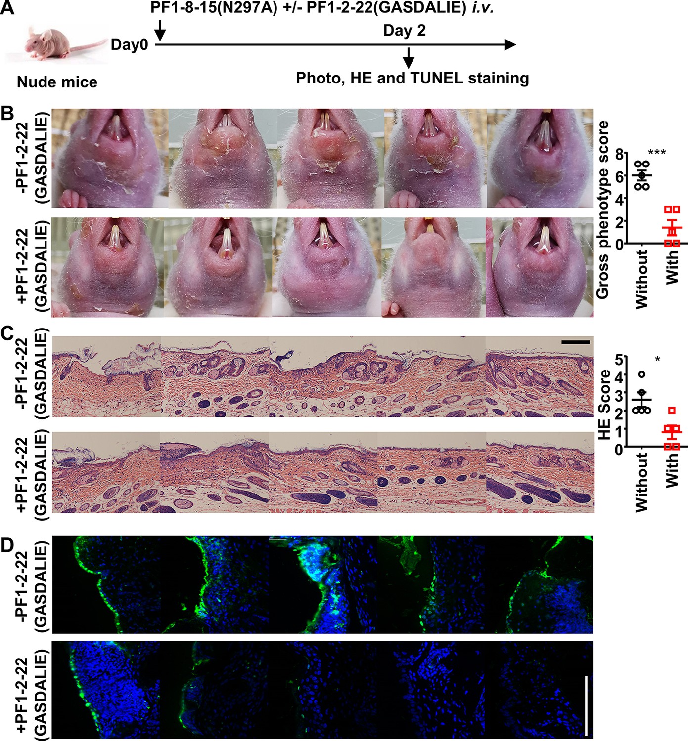 Distinct impact of IgG subclass on autoantibody