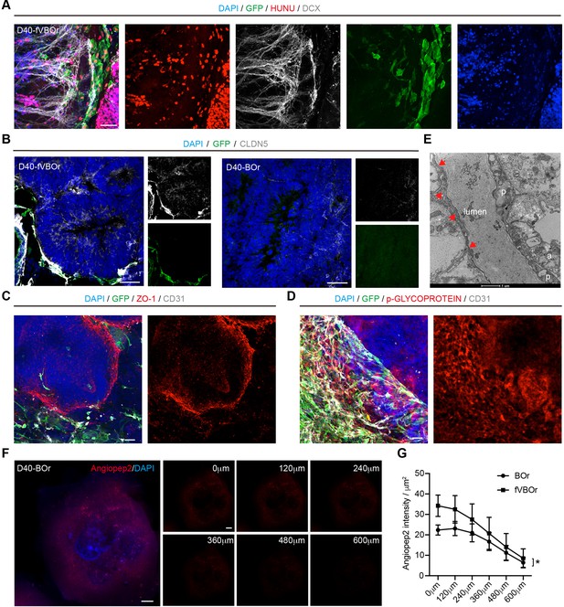 Figures and data in Generation of vascularized brain organoids to study ...