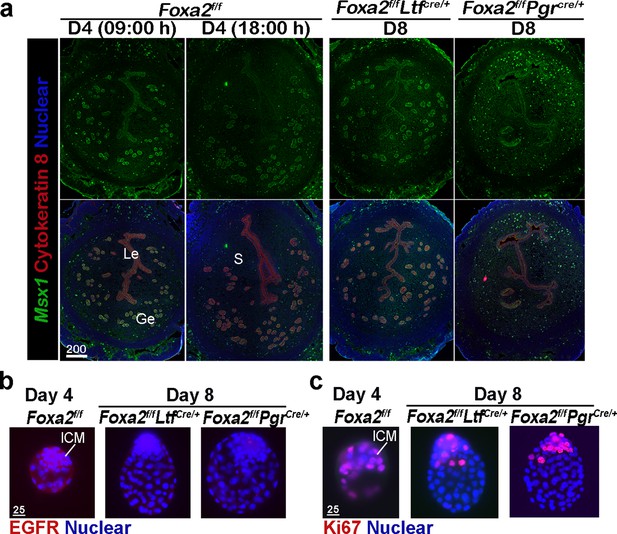 Targeted Depletion Of Uterine Glandular Foxa2 Induces Embryonic