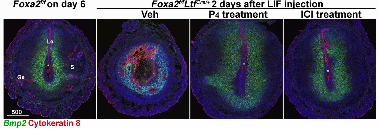 Figures And Data In Targeted Depletion Of Uterine Glandular Foxa