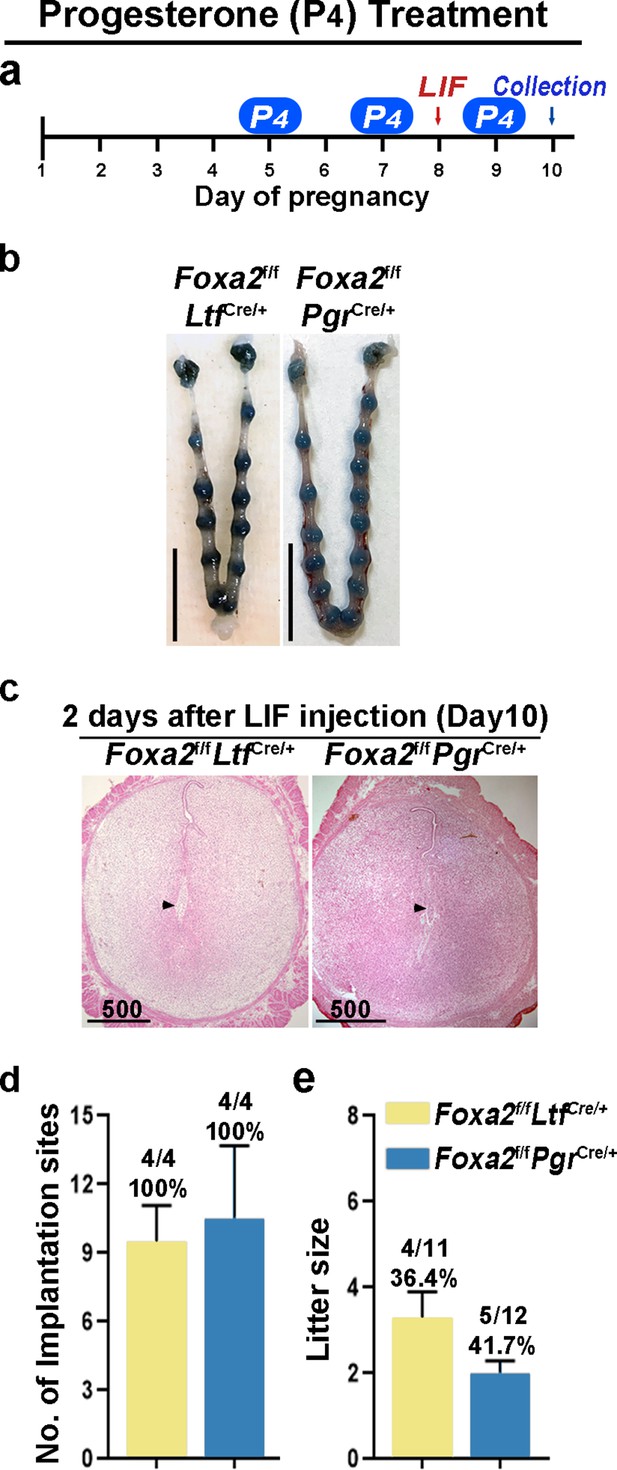 Targeted Depletion Of Uterine Glandular Foxa Induces Embryonic