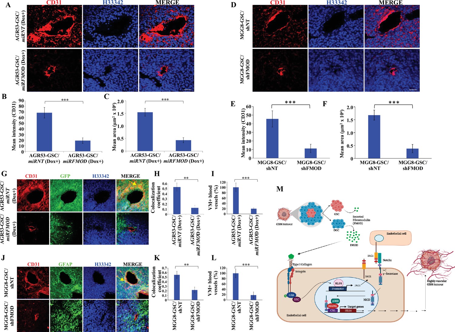 Differentiated glioma cell-derived fibromodulin activates integrin ...