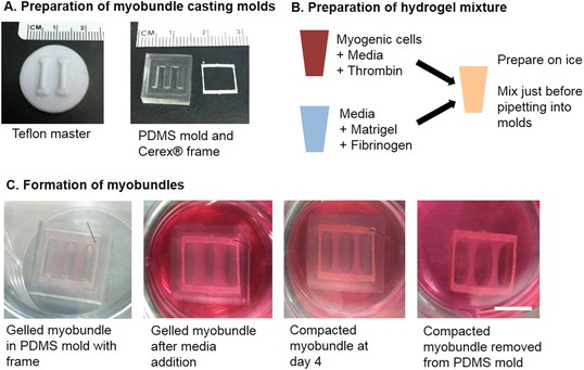 Figures and data in Bioengineered human myobundles mimic clinical ...