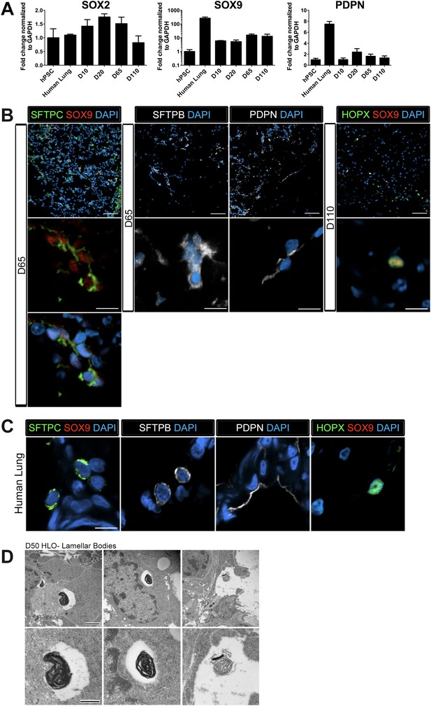 In vitro generation of human pluripotent stem cell derived lung ...