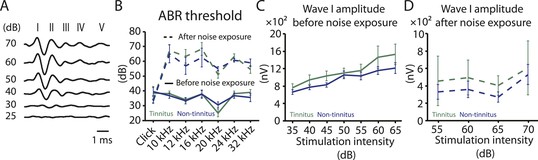 Noise-induced plasticity of KCNQ2\/3 and HCN channels underlies ...