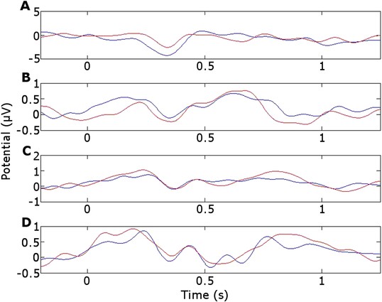 Figures and data in Thalamic theta phase alignment predicts human ...